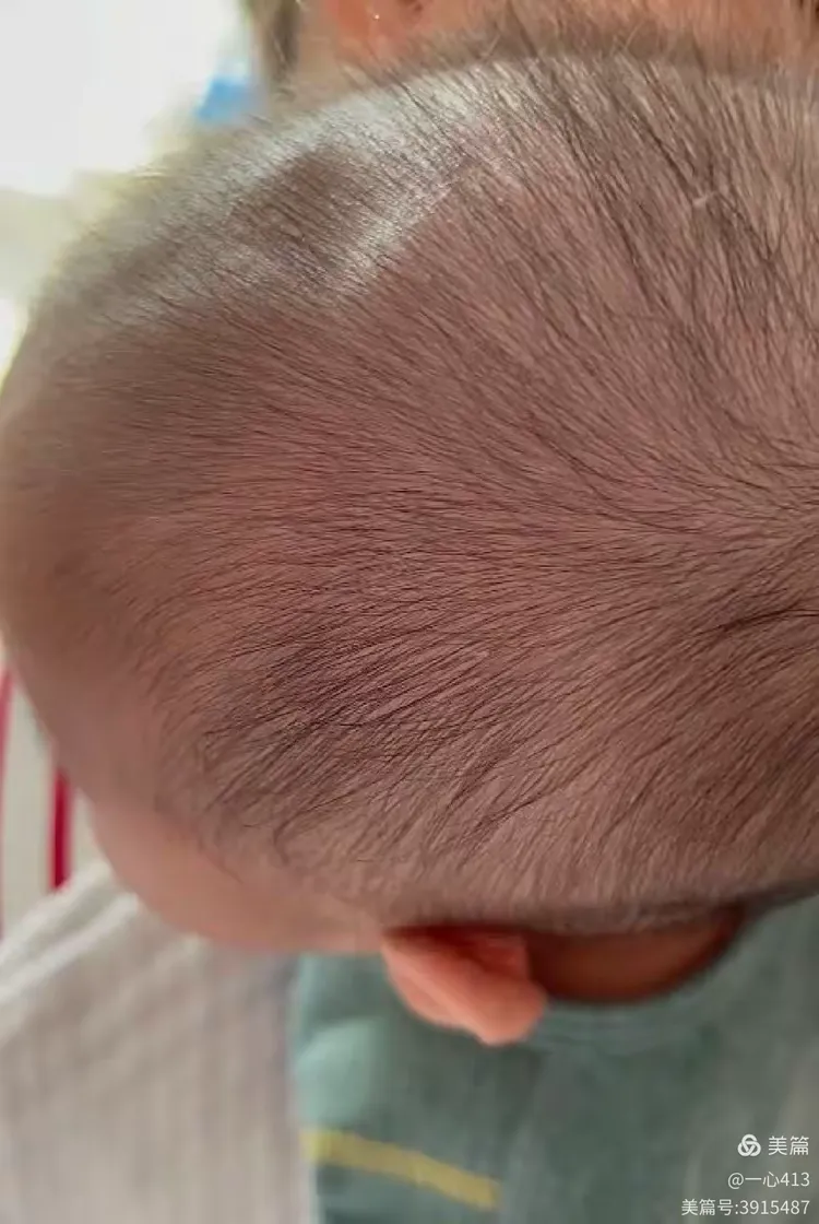 宝宝出生以后,头部会有两个比较柔软的"坑",这两个